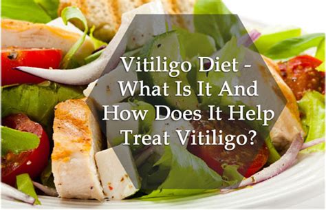 Vitiligo Diet: What to eat and avoid in Vitiligo - Vitiligo Treatment