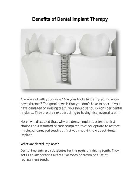 PPT Benefits Of Dental Implant Therapy PowerPoint Presentation Free