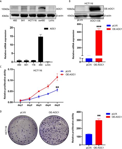 Frontiers Increased Aoc1 Expression Promotes Cancer Progression In