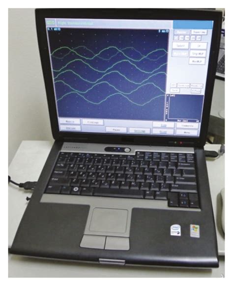 Electromyography equipment, Keypoint device. | Download Scientific Diagram