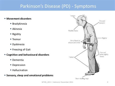 Matteo Pastorino - Remote daily activity of parkinson’s disease patie…