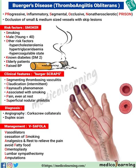 Buerger’s Disease (Thromboangiitis obliterans) – MedicoLearning