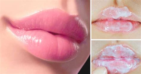 CONSIGUE LABIOS ROSADOS Medicina Casera Para El Hogar