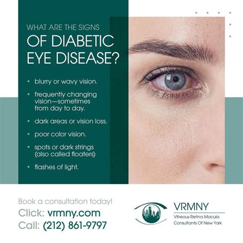 Vitreous Retina Macula Consultants Of New York Retinal Tears And