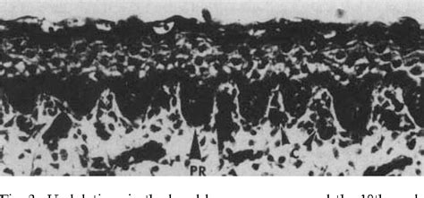 Epidermal Ridge | Semantic Scholar