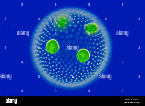 Volvox Green Algae Rheinberg Illuminated Light Micrograph Of Volvox