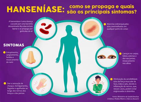 30 de janeiro Dia Nacional de Combate e Prevenção da Hanseníase