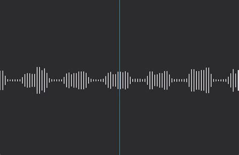 Is this a normal heartbeat?! Doctor said it’s normal but I don’t think it is. : r/askCardiology