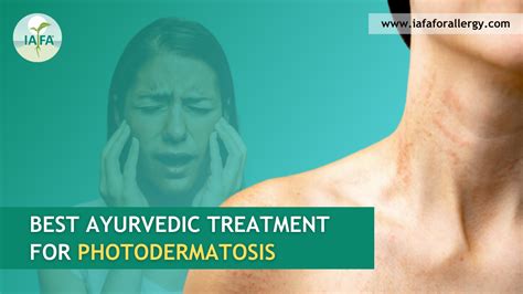 What is the Best Ayurvedic Treatment for Photodermatosis?