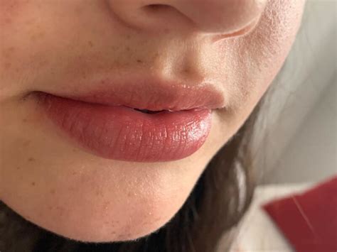 Causas De La Resequedad En Los Labios Madame Bio