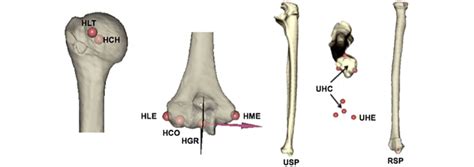 Medial Epicondyle Humerus Anatomy