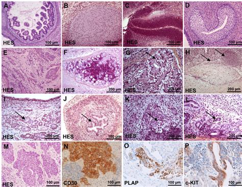 Histological Analysis Of Teratomas By Haematoxylin And Eosin Staining