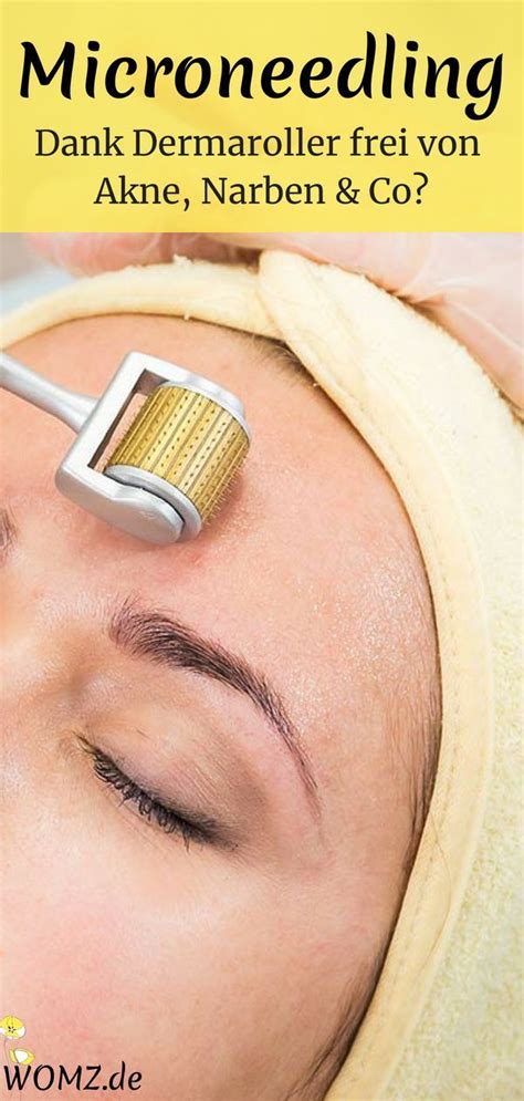 Microneedling Selber Machen So Geht S Mit Dem Dermaroller WOMZ