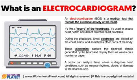 What is an Electrocardiogram?