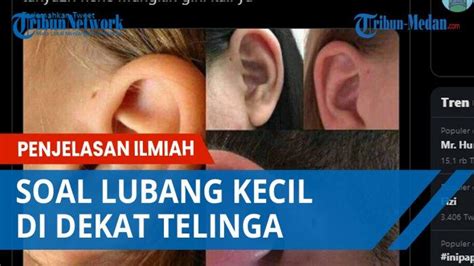 Tag Lubang Kecil Di Dekat Telinga Lubang Kecil Di Dekat Telinga Jadi