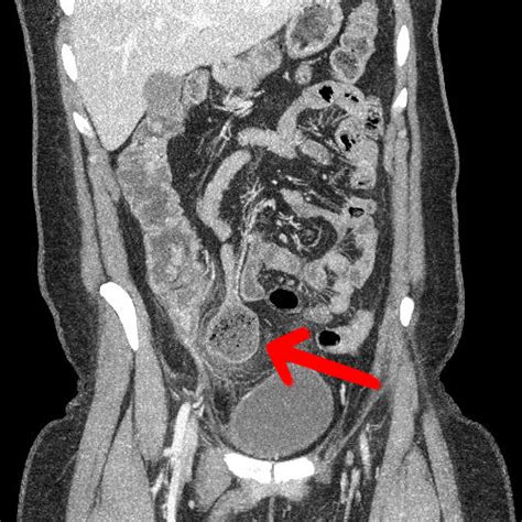 Image Radiopaedia Org