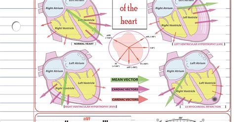 ECG Educator Blog : Cardiac Axis Made Easy