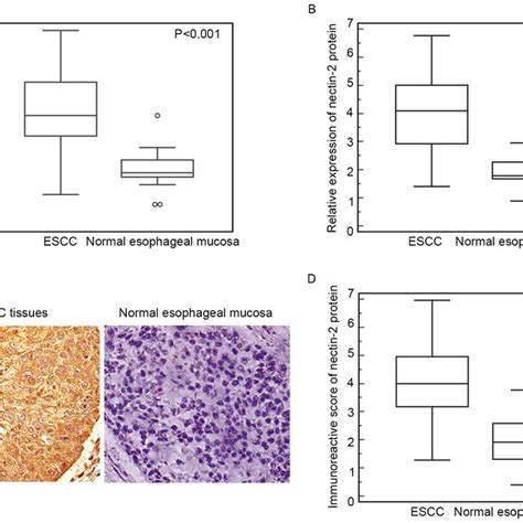 Loss Of Nectin 2 Protein Expression In The Human Esophageal Squamous