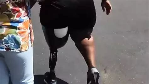 Free BBW Amputee P HD Porn Videos XHamster
