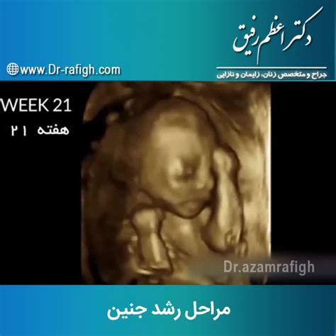 فیلم مراحل رشد جنین دکتر اعظم رفیق جراح و متخصص زنان و زایمان و