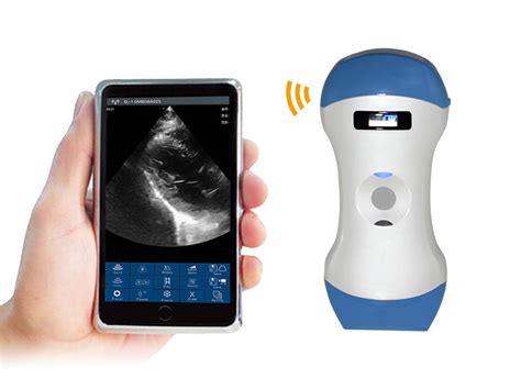 5CPL 3in1 palm doppler ultrasound – MedNVet