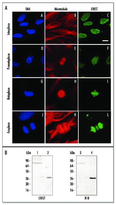 Immunofluorescence Staining And Western Blotting Patterns Of The CREST