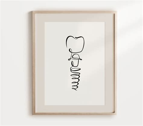 Arte imprimible de implante dental Ilustración de línea de diente