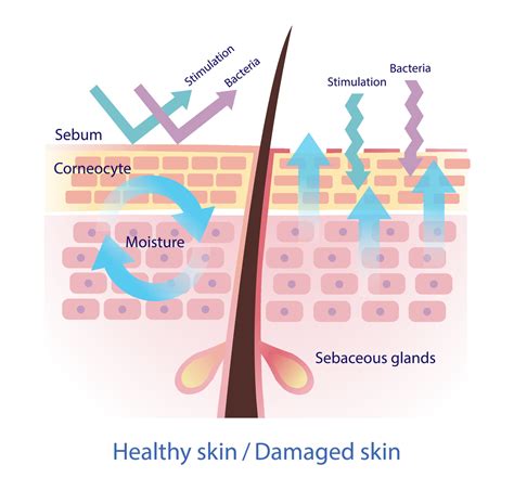 Comparison Of Healthy And Damaged Skin Barrier Vector On White