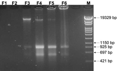 Electrophoretic Analysis Of The Nucleic Acids Associated To Fractions