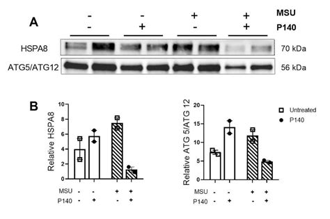 Effect Of P140 Peptide On The Expression Of Atg5 Atg12 Complex And