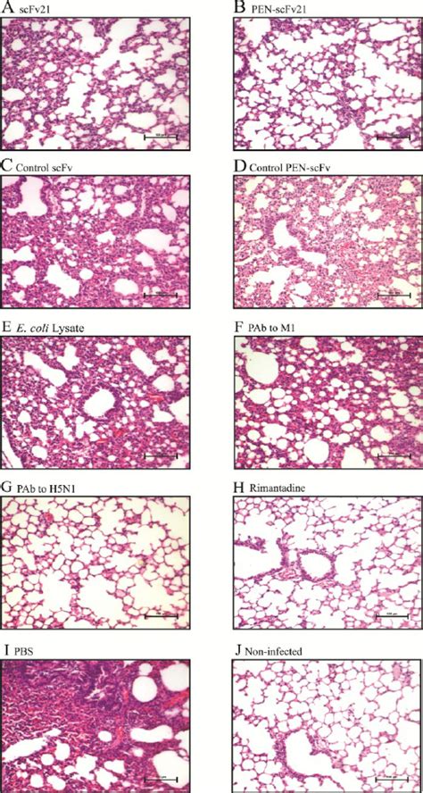 Histopathological Features In Lung Sections Of Mice Infected With 10