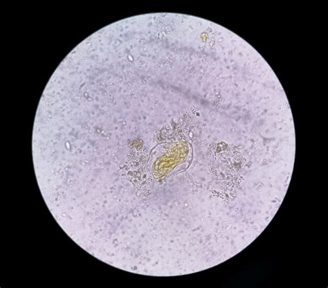 Examen De Heces Bajo Microscop A De Luz An Lisis De Las Heces Foto