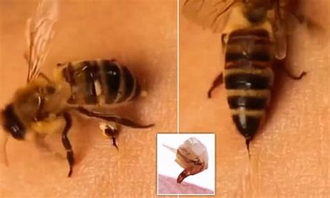 Horrifying Close Up Video Reveals What Happens When A Bee Stings And