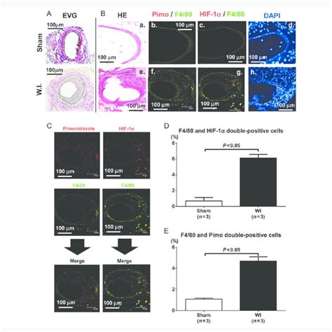 Macrophage Proliferation And Migration Assay In Vitro A Effects Of