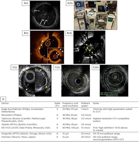 Editors Pick Contemporary Use Of Intracoronary Imaging In