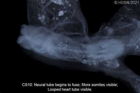 Human Embryo Carnegie Stages