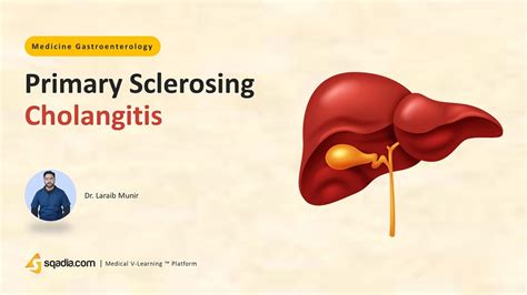 Primary Sclerosing Cholangitis