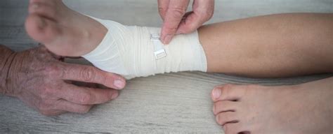 Sprains Strains Fractures Cornerstone Foot Ankle Atelier Yuwaciaojp