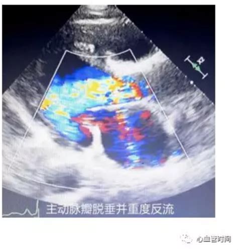 心脏超声：10 大切面，一文搞定！ 丁香园