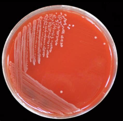 Listeria Bacteriology Flashcards Quizlet