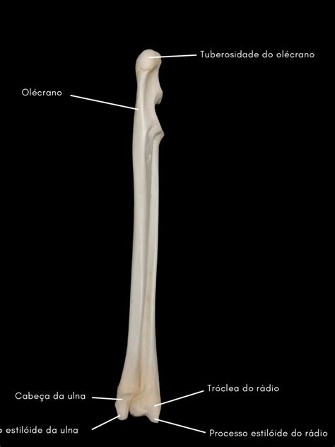 3 4 rádio e ulna direitos vista caudal Download Scientific Diagram