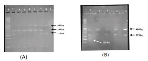 Showing The Polymorphic Gst Gene Pcr Bands On The Agarose Gel