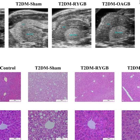 A B Scan Images Of The Liver And Kidneys A Blank Control Group B