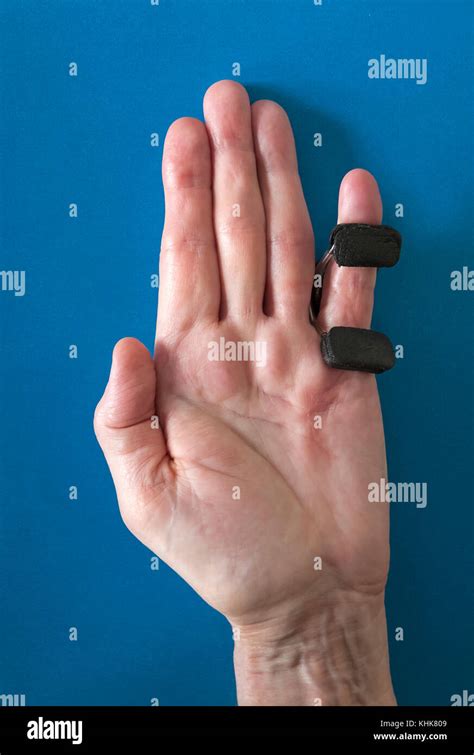 Dupuytrens Contracture Splint