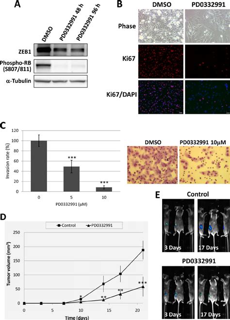 The Cdk Inhibitor Pd Suppresses Zeb Expression And Tumor