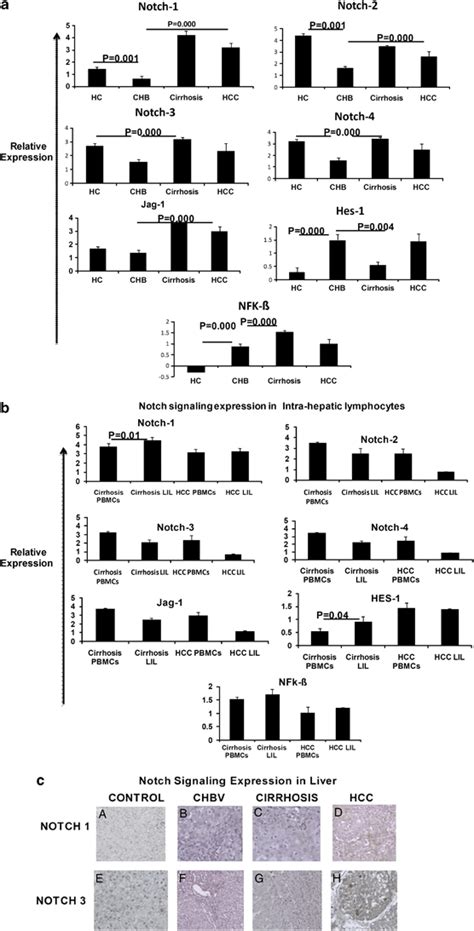 Quantitative Real Time Pcr Analysis And Immunohistochemical Analysis Of