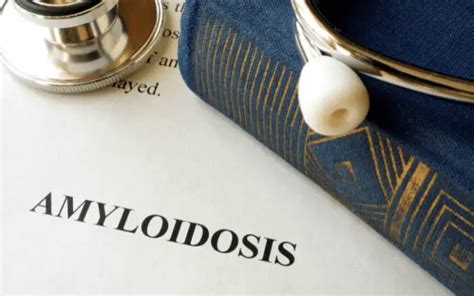 Understanding Amyloidosis: Top 20 Symptoms You Should Know