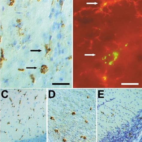 Brain histology. H&E stained tissue sections from brain stem ( A , C ... 