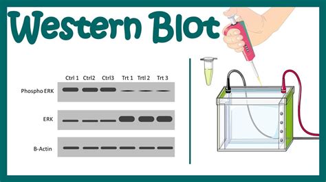 Blotting Techniques The Principle Of Western Blotting Western Blot