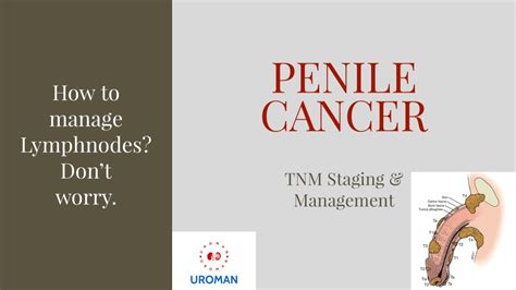 PENILE CARCINOMA TNM Staging And Management YouTube